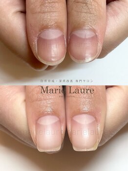 マリーロール 淀屋橋本店(Marie Laure)/自爪育成/深爪矯正/ネイルケア