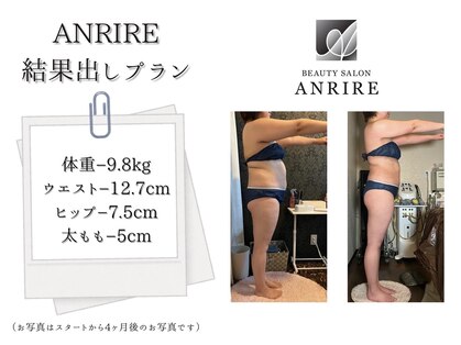 アンリール 苫小牧店(ANRIRE)の写真