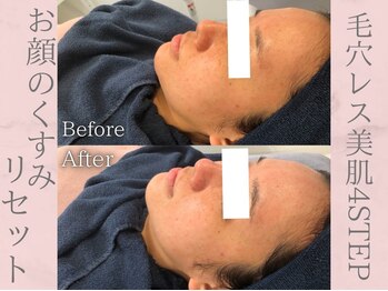 ネオファースト(NeoFirst)/顔のくすみもリセット♪