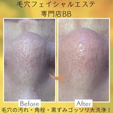 ビービー(BB)