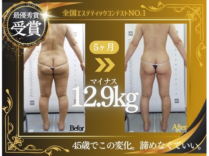 美楽の写真