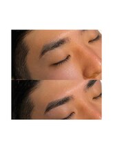 アノマリー 六本松店(Anomaly)/フェイシャルワックス講師が担当