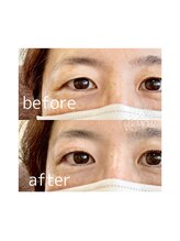 ジョリレーヌ(Jolie Reine)/