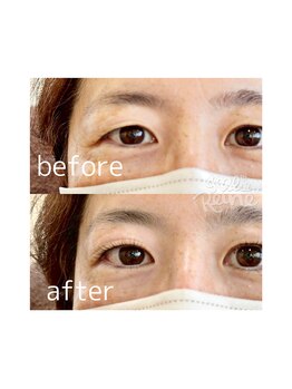 ジョリレーヌ(Jolie Reine)/