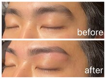 クラシックス(CLASSICS)/美眉wax脱毛