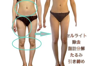 広尾痩身ビューティーサロン/【痩身/広尾/ダイエット】