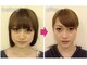 ローズ ド ナチュール(Rose de Nature)の写真/むくみ・たるみが改善◎コルギで目指す理想のフェイスライン！小顔効果を実感☆