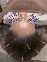 オカ鍼灸院(OKA鍼灸院)/