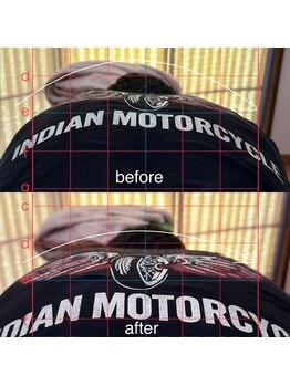 カイロプラクティック ネクサス/腰痛とお尻の痺れ撃退☆