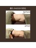 【気になるお腹ラクしてスッキリ】YOLO式腸もみ50分