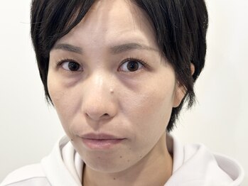 トミー(Tommy)/まつ毛パーマ