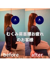 ギフトリラクゼーション 久留米(GIFTリラクゼーション)/☆before &nbsp;&nbsp;after☆