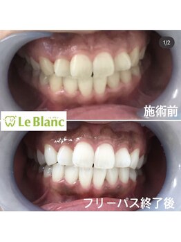 ルブラン 奈良店(Le Blanc)/オススメのフリーパス!!