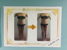 ビューティーボディー 小岩(Beauty Body)/35歳１２回変化