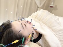 瑞 鍼灸院