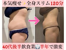 マール(Mar)/ビフォーアフター　全身痩身