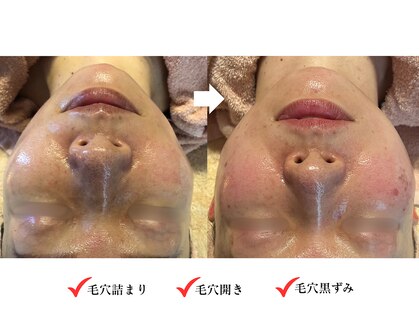 サロン アイプラス(salon i plus)の写真
