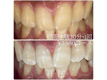 ホワイトニングルーム 横浜店(Whitening Room)/セルフホワイトニング/横浜