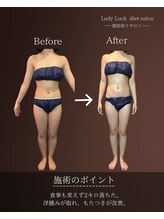 レディラック 大阪梅田本店(Lady Luck)/がっつりサイズダウンコース