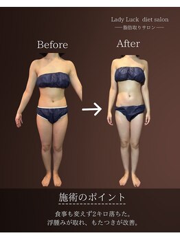 レディラック 大阪梅田本店(Lady Luck)/がっつりサイズダウンコース