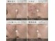 アエ(ae)の写真/ニキビ/跡と開き毛穴をケア◎続けやすい料金で魅力的な肌へ導くエステ以上医療未満★