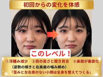 メディピークスの写真/《河原町/四条》当店人気NO.1♪【ソフト小顔矯正×全身姿勢骨盤矯正】お顔のお悩みを劇的改善◎