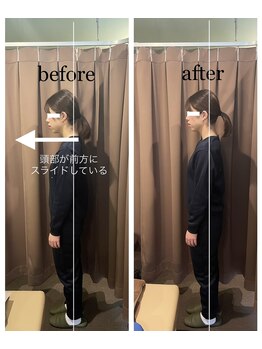 アイリー(Irie)/姿勢矯正