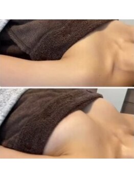 エスビューティー 三軒茶屋(S beauty)/バストケア・池尻大橋・痩身ケア