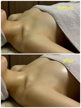 ベッピン(Beppin)/バストハリ/ブライダル