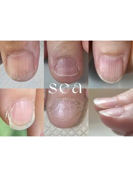 爪の悩みを解消できる（ケア含む）