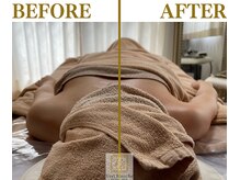 ヴェールブランシュ 町田(Vert Blanche)/#ブライダルエステ#痩身#肩