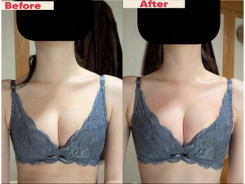 スノードロップ(snowdrop)/