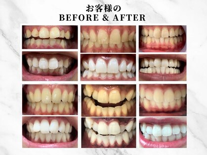 キラット 金沢鞍月店(Kiratt)の写真