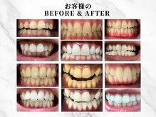 キラット 金沢鞍月店(Kiratt)