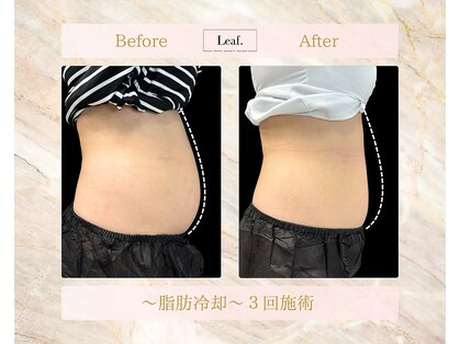 リーフ(Leaf.)の写真