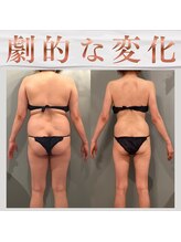 ボディエステティック アクアオーラ 富山店