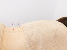 TJMととの鍼灸院/【鍼灸】更年期症状にも対応