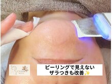 クリアホワイト(Clear White)/ピーリングでザラつきケア♪