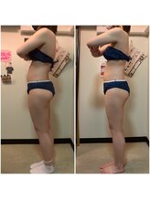 骨盤ストレッチ整体 b/腰痛改善