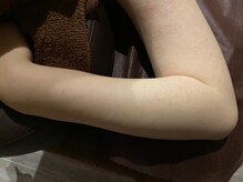 ルアナアイナ 池袋店(Luana Aina)/REVI陶肌トリートメントで肌改善