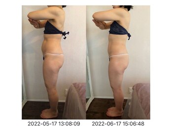 サロン ド カシェット 銀座/お客様のビフォーアフター例