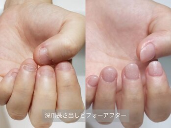 ミンスネイル(Mins Nail)/