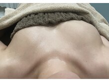 セレーネ(Selene)/片側施術！