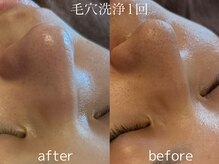 グランクウォーレ(Gran Cuore)/毛穴レス★