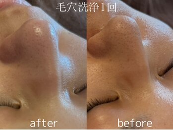 グランクウォーレ(Gran Cuore)/毛穴レス★