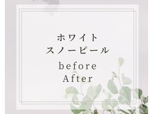 ココ 2号店(CoCo)/ホワイトスノーピール/白雪肌