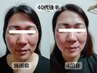 【セットメニュー】たるみケアフェイシャル+全身リンパ90分 ＆温活30分