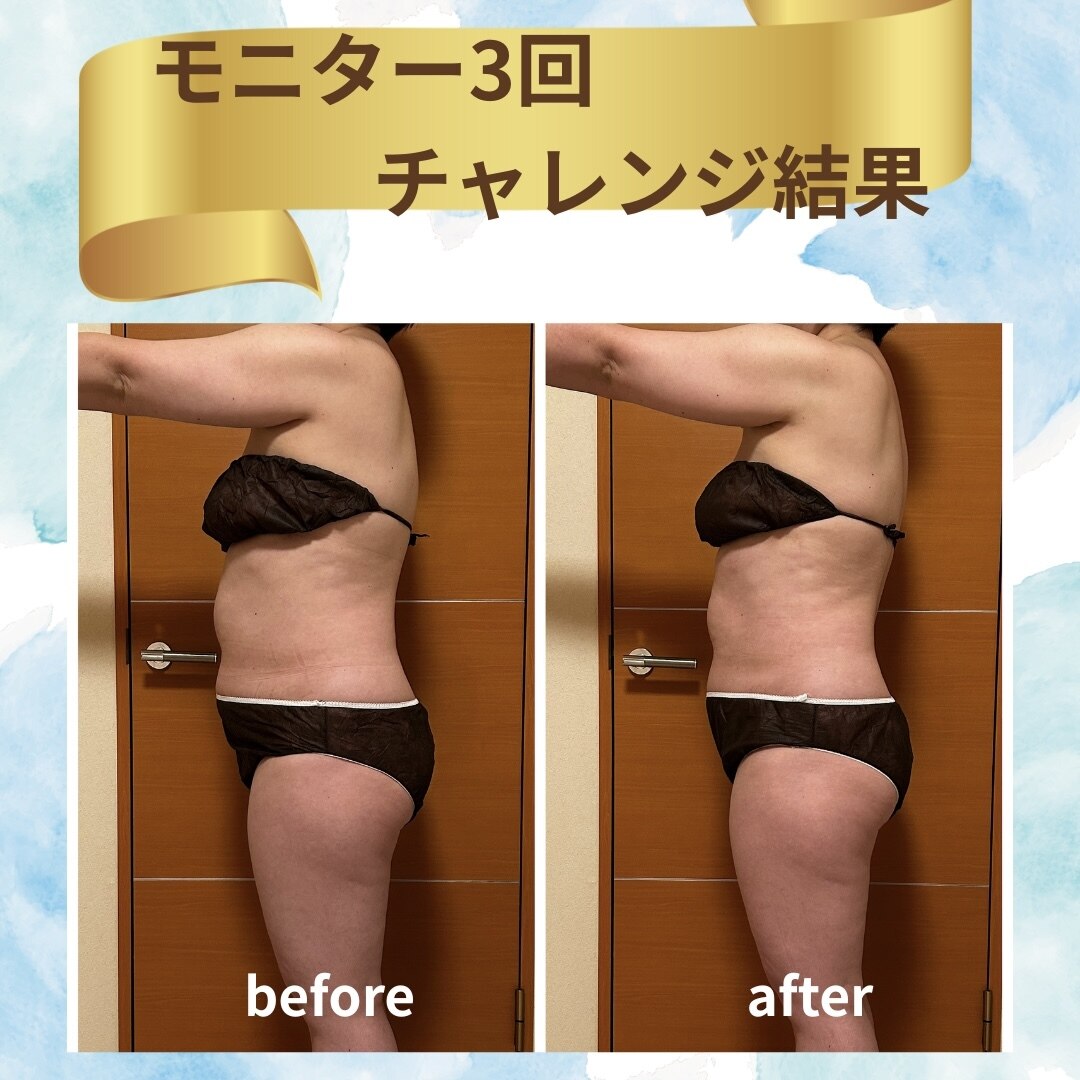 ヨサパーク フラネ(YOSA PARK Flaner)｜ホットペッパービューティー