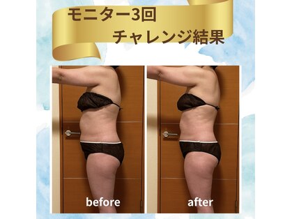 ヨサパーク フラネ(YOSA PARK Flaner)の写真