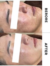 ゼロ 水戸店(ZERO)/ダクトピール